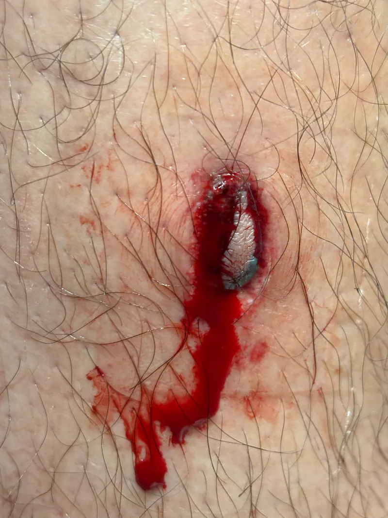 Before suture repair on leg