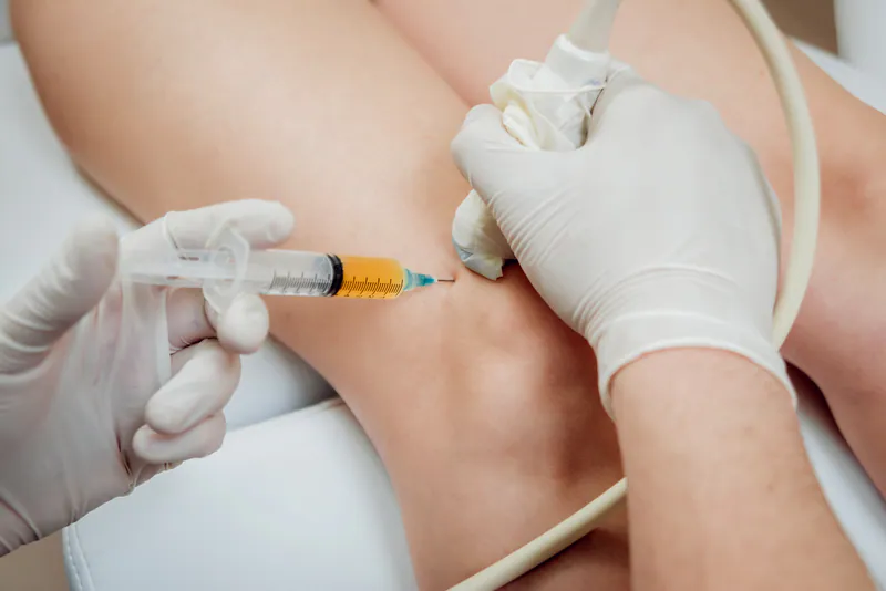 PRP injection for joint pain management